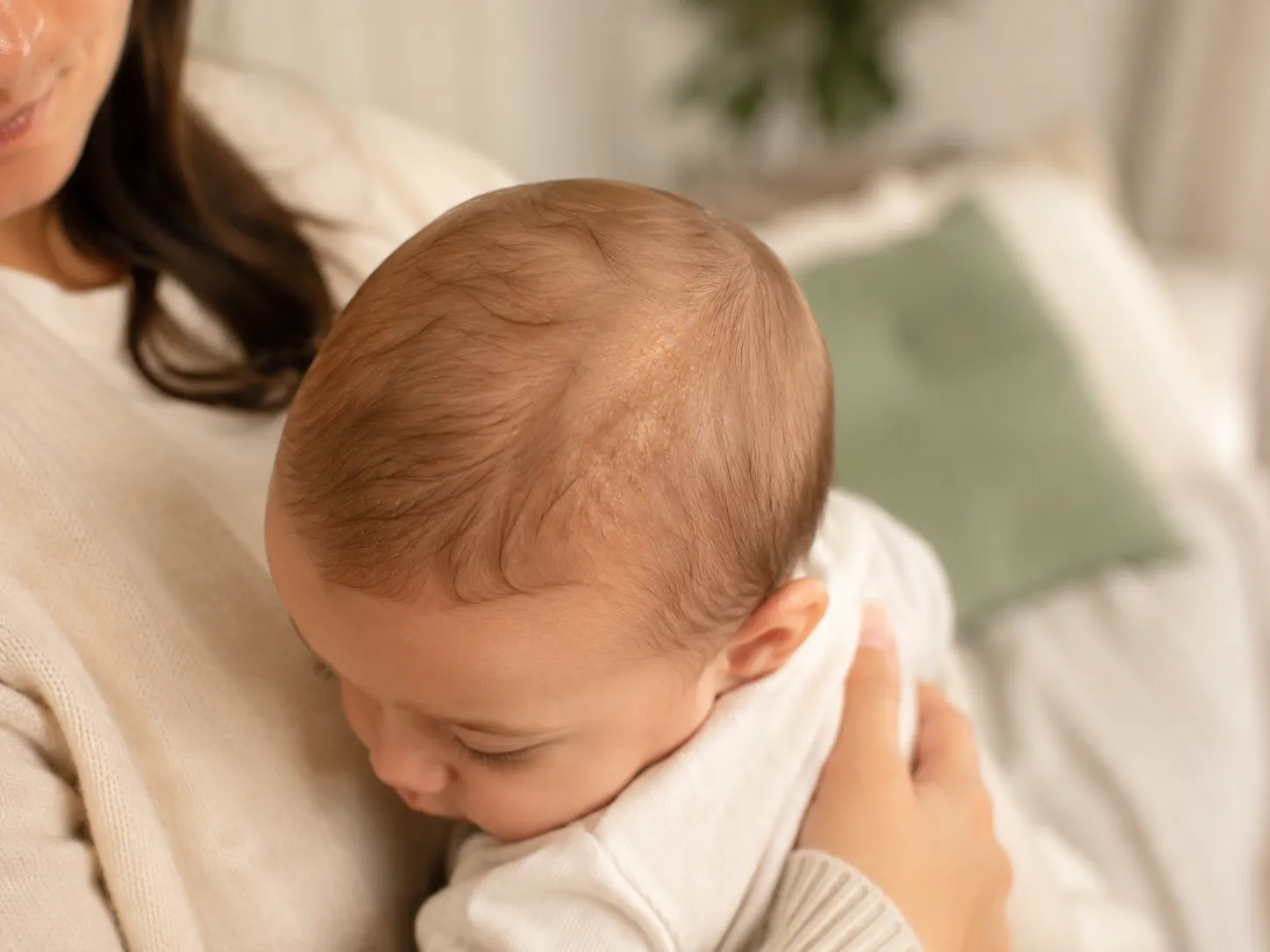 Bébé porté dans les bras d’un parent avec de légères croûtes de lait visibles sur le cuir chevelu