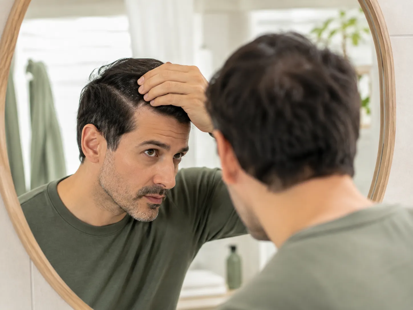 Homme examinant son cuir chevelu devant un miroir, avec des squames évoquant un psoriasis du cuir chevelu.